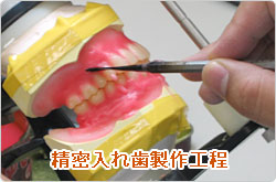 精密入れ歯製作工程