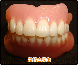 超精密義歯