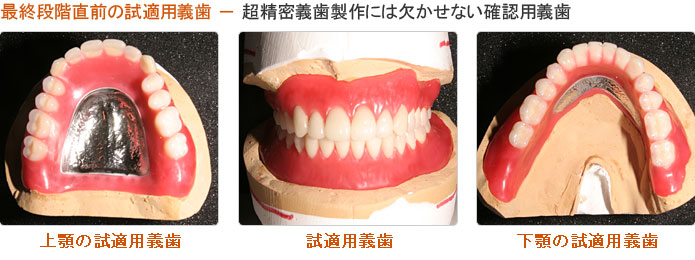最終段階直前の試適用義歯